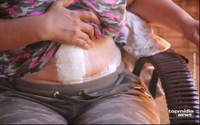 Campo Grande: Mulher esfaqueada pelo ex no Canguru nega estupro e diz não guardar mágoas 